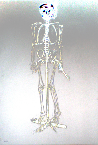 skelet