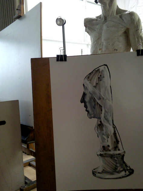 plaster cast